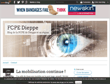 Tablet Screenshot of fcpe-dieppe.over-blog.com