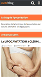 Mobile Screenshot of lipocavitation.over-blog.com