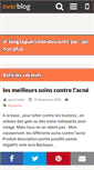 Mobile Screenshot of laguerredesboutons.over-blog.com